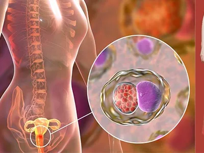HPV ilişkili lezyonlar (rahim ağzı lezyonları)